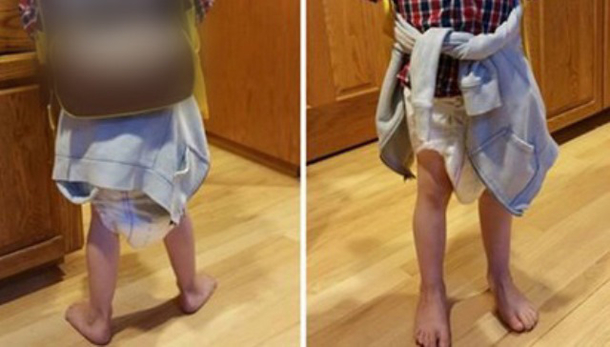 Child Comes Home Crying Without Pants, Mom's Horrified When She Sees What’s Hanging Down - picture 3