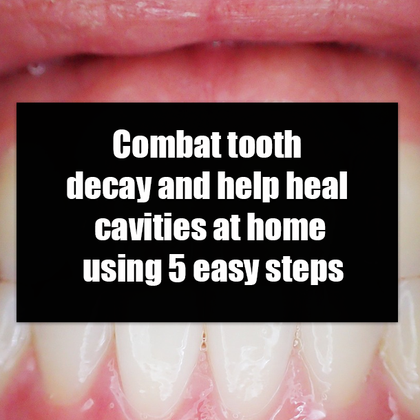 Combat tooth decay and help heal cavities at home using 5 easy steps