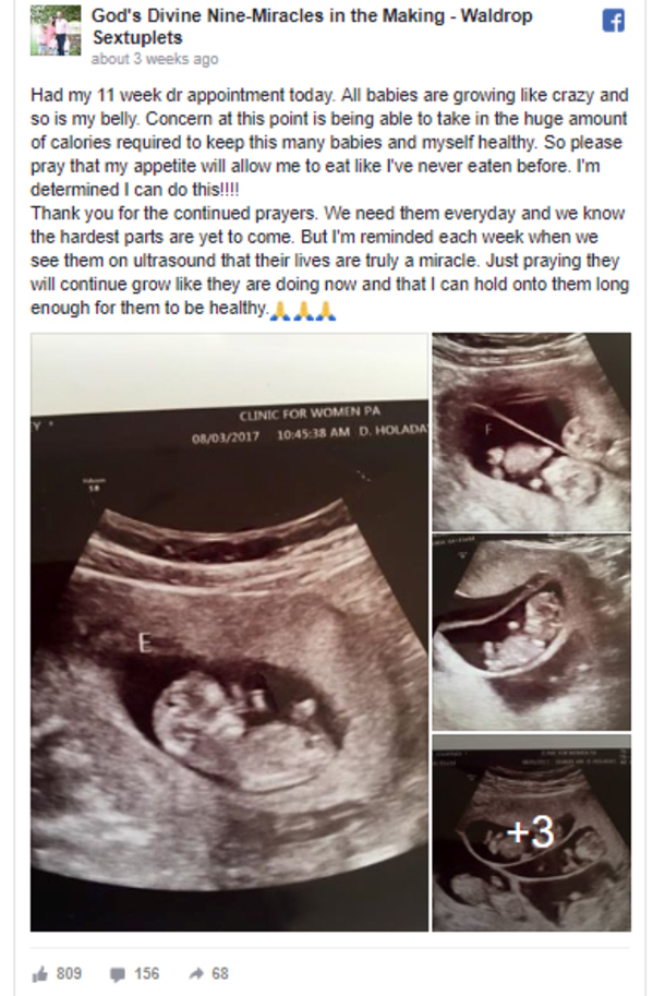 Couple Devastated After Miscarriages, Once They See Ultrasound; Their Hearts Drop - picture 4