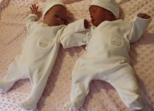 Couple Expecting Identical Twins, Doctors Give Them News That Turn Their World Upside Down - picture 2
