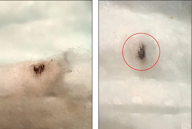 Couple Makes Horrifying Discovery In Baby's Diaper - picture 2