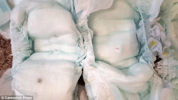 Couple Makes Horrifying Discovery In Baby's Diaper - picture 3