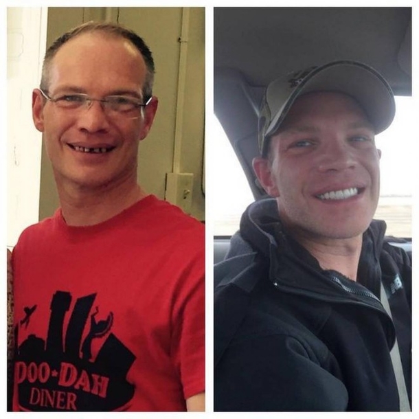 Customer’s Actions After Noticing Waiter’s Bad Teeth Left People Speechless - picture 4