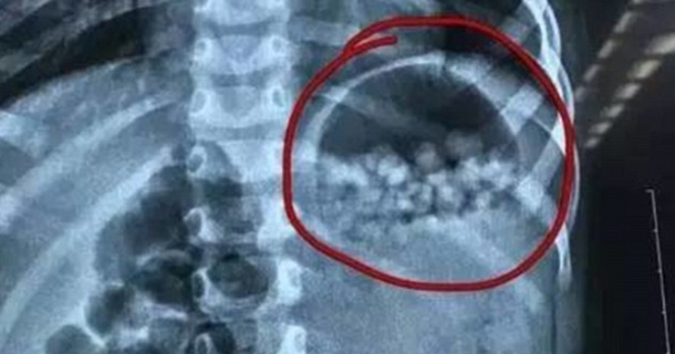 Dad Feeds Toddler At Least 200 Pieces Of 'Candy.' Then Mom Tries One And Spits It Out. That's When It Hits Her. - picture 2