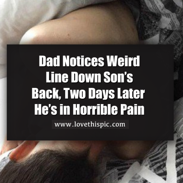 Dad Notices Weird Line Down Son’s Back, Two Days Later He’s in Horrible Pain