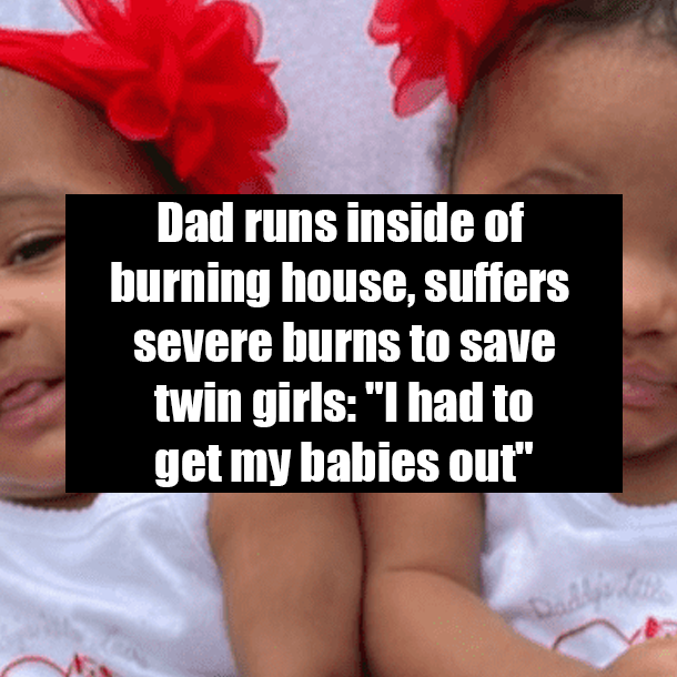 Dad runs inside of burning house, suffers severe burns to save twin girls: "I had to get my babies out"