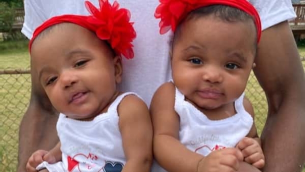 Dad runs inside of burning house, suffers severe burns to save twin girls: "I had to get my babies out" - picture 3