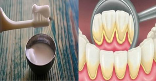 DENTISTS HIDE THIS FROM THE PUBLIC! THIS SIMPLE MIXTURE CAN REMOVE THE PLAQUE FROM YOUR TEETH IN JUST A COUPLE OF DAYS! - picture 2