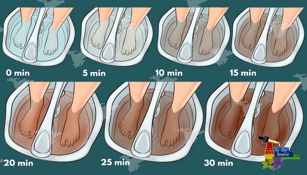 Did You Know That You Can Detox Your Body Through Your Feet? This Works IMMEDIATELY! - picture 2