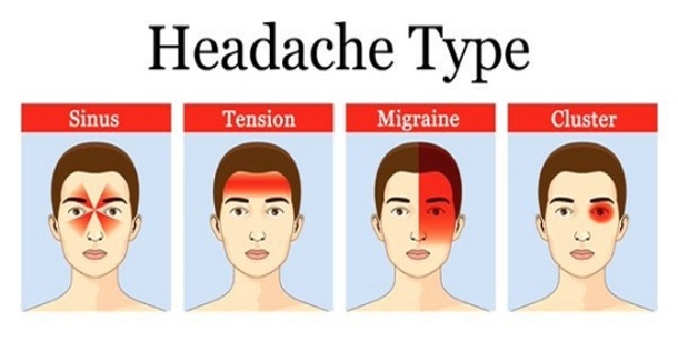 Different Headache Types And How To Treat Them - picture 2
