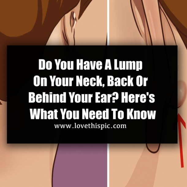 Do You Have A Lump On Your Neck, Back Or Behind Your Ear? Here's What You Need To Know