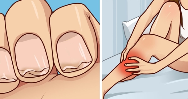 Do you have weak nails? Frequent leg cramps? Here’s what you need to know - picture 2