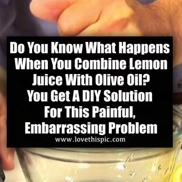 Do You Know What Happens When You Combine Lemon Juice With Olive Oil? You Get A DIY Solution For This Painful, Embarrassing Problem