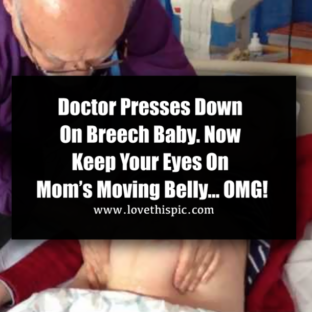 Doctor Presses Down On Breech Baby. Now Keep Your Eyes On Mom’s Moving Belly… OMG!