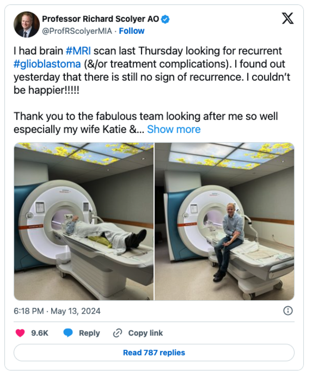 Doctor Remains Cancer-Free After Incurable Brain Tumor Diagnosis, Thanks to His Own Treatment - picture 3