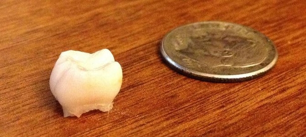 Doctors Are Urging Parents Everywhere To Keep Their Kids’ Baby Teeth - picture 2