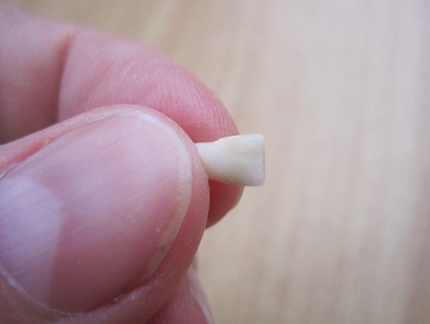 Doctors Are Urging Parents Everywhere To Keep Their Kids’ Baby Teeth - picture 3