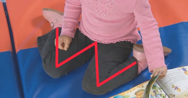 Doctors Are Warning All Parents Not To Let Their Children Sit In “W” Position, Here’s Why - picture 2