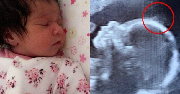 Doctors Give Mom 4-Word Prediction At Ultrasound, Baby Stuns All At Birth - picture 2