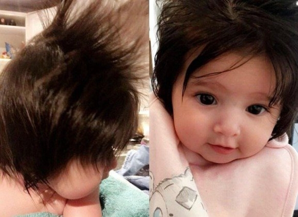 Doctors Give Mom 4-Word Prediction At Ultrasound, Baby Stuns All At Birth - picture 3
