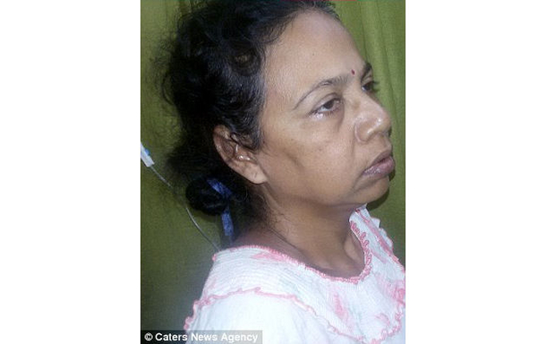 Doctors Just Found 12,000 Of These Inside A Woman's Stomach (Photo) - picture 2