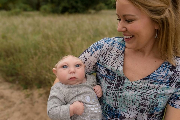Doctors Said Jaxon Wouldn’t Survive, Now He’s Turning Two - picture 2