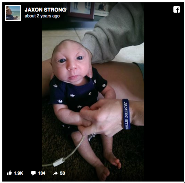 Doctors Said Jaxon Wouldn’t Survive, Now He’s Turning Two - picture 3