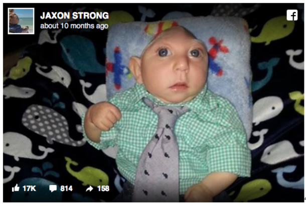 Doctors Said Jaxon Wouldn’t Survive, Now He’s Turning Two - picture 4