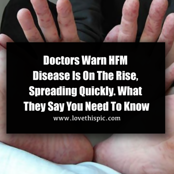 Doctors Warn HFM Disease Is On The Rise, Spreading Quickly. What They Say You Need To Know