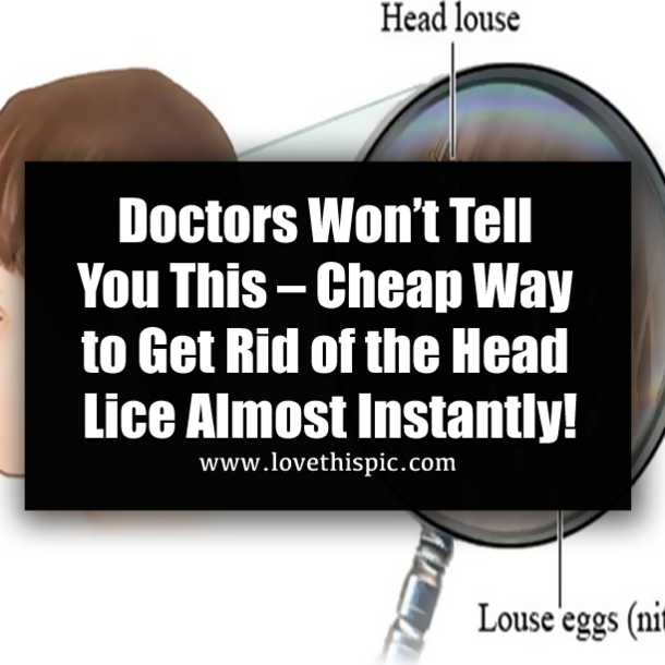 Doctors Won’t Tell You This – Cheap Way to Get Rid of the Head Lice Almost Instantly!
