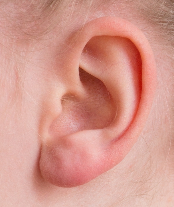 Does Your Ear Itch On The Inside? This Is What It Means And How To Treat It - picture 2