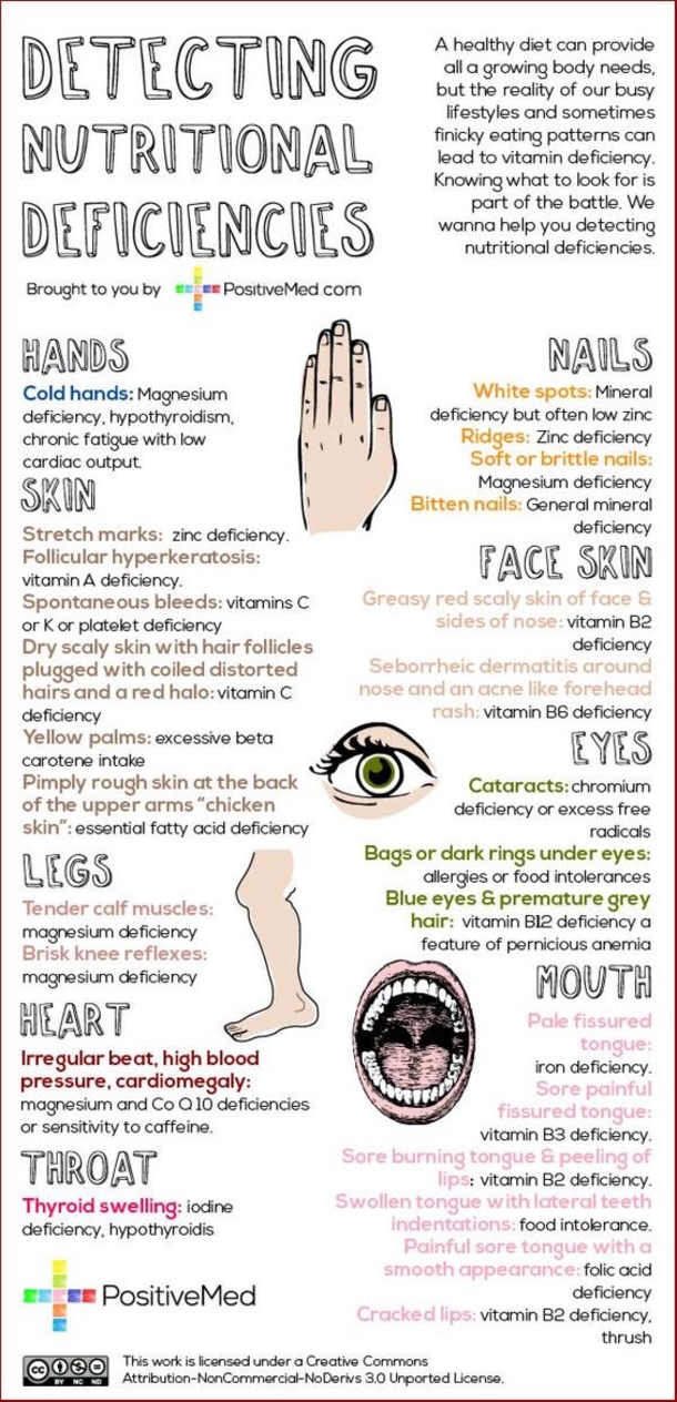 Early Warning Signs That Your Body’s Magnesium Levels Are Dangerously Low - picture 5