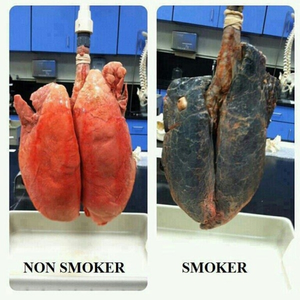Elixer can help clear your lungs, a boon for smokers - picture 2