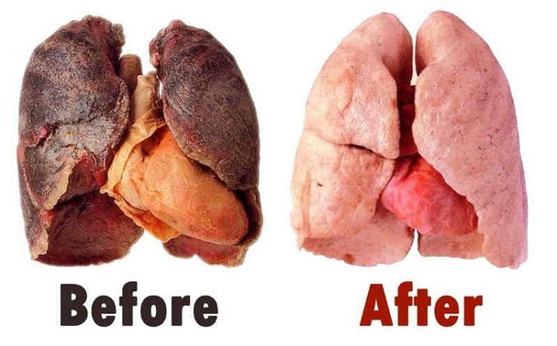 Elixer can help clear your lungs, a boon for smokers - picture 3