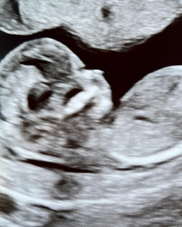 Emotional reunion captured in viral TikTok video as woman find birth mom after 34 years - picture 9