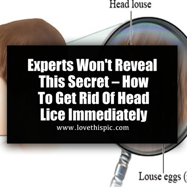 Experts Won't Reveal This Secret – How To Get Rid Of Head Lice Immediately