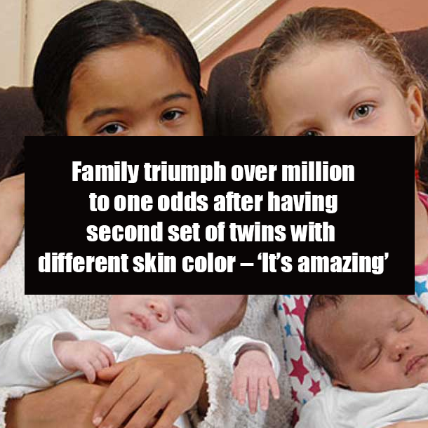Family triumph over million to one odds after having second set of twins with different skin color – ‘It’s amazing’