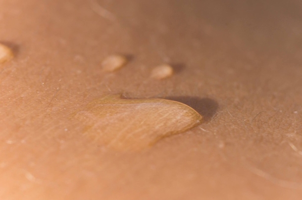 Fast, Easy And Remedy To Remove Skin Tags At Home - picture 2
