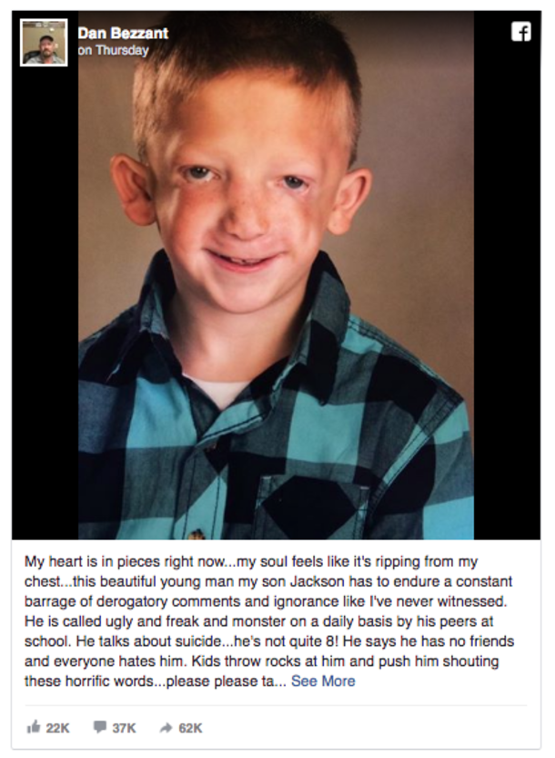 Father Devasted After Bullies Call Son A Monster; Crying & Upset, He Does What Any Parent Would Do - picture 2