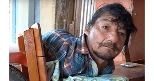 Father Without Limbs Raises Two Daughters Solo After Their Mother Abandons Them As Infants - picture 2