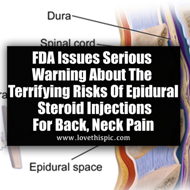 FDA Issues Serious Warning About The Terrifying Risks Of Epidural Steroid Injections For Back, Neck Pain