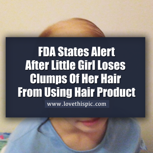 FDA States Alert After Little Girl Loses Clumps Of Her Hair From Using Hair Product