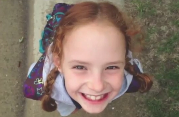 FDA States Alert After Little Girl Loses Clumps Of Her Hair From Using Hair Product - picture 2