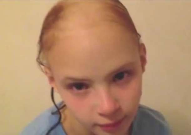 FDA States Alert After Little Girl Loses Clumps Of Her Hair From Using Hair Product - picture 3