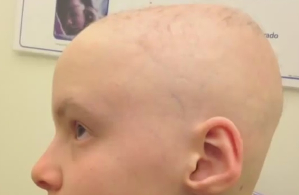 FDA States Alert After Little Girl Loses Clumps Of Her Hair From Using Hair Product - picture 4