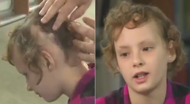 FDA States Alert After Little Girl Loses Clumps Of Her Hair From Using Hair Product - picture 9