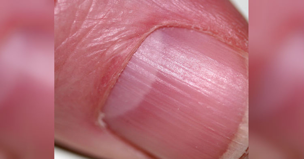 Few People Know The Half Moon Shape On Your Nail Could Save Your Life. What You Need To Know - picture 2