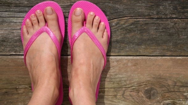 Flip Flops Are Dangerous For Your Feet During The Summer And This Is The Reason Why - picture 2