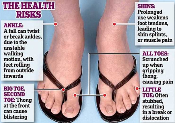 Flip Flops Are Dangerous For Your Feet During The Summer And This Is The Reason Why - picture 3