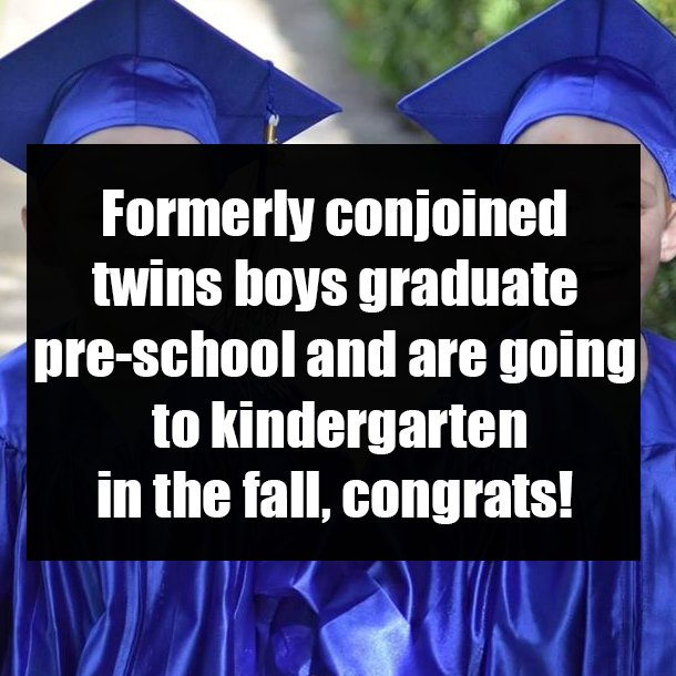 Formerly conjoined twins boys graduate pre-school and are going to kindergarten in the fall, congrats!